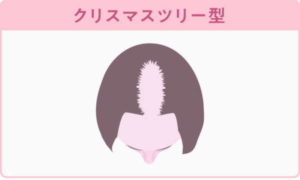 FAGAのクリスマスツリー型が分かる画像