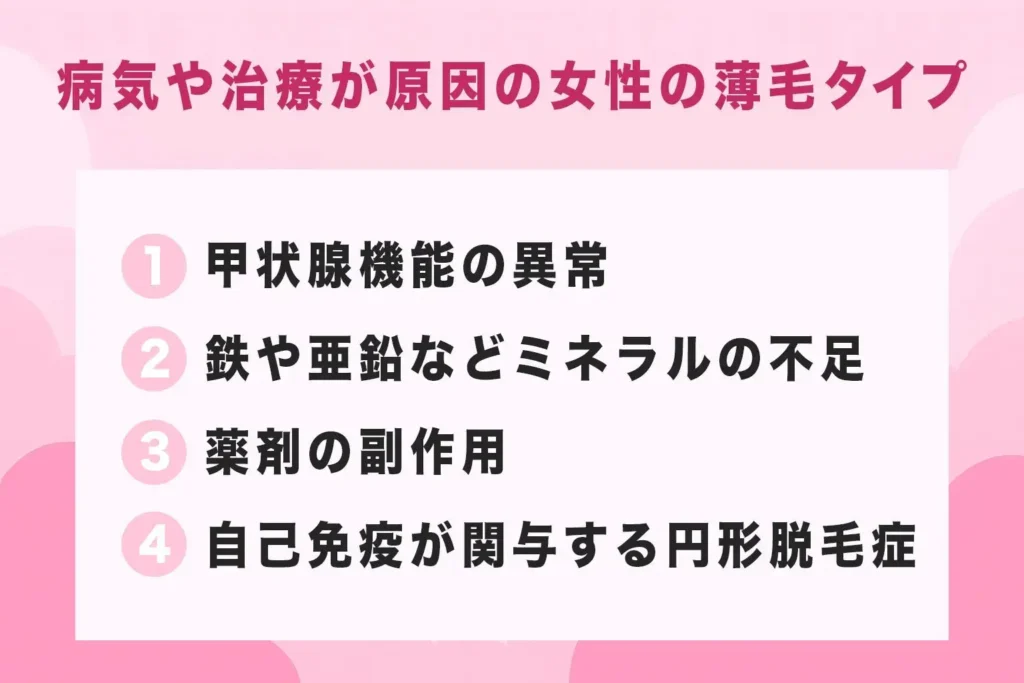 病気や治療が原因の女性の薄毛タイプが分かる画像
