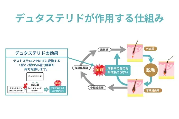 デュタステリドが作用する仕組みが分かる画像