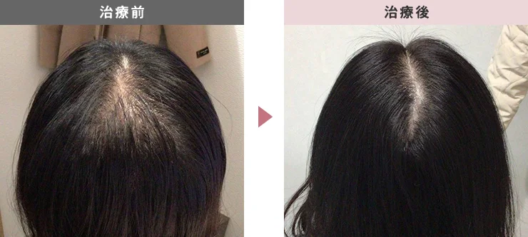 【40代女性】の症例