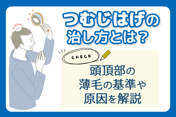 つむじはげの治し方とは？ 頭頂部の薄毛の基準や原因を解説
