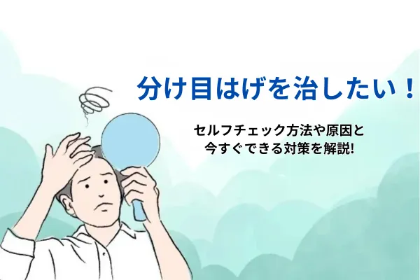 分け目はげを治したい！セルフチェック方法や原因と今すぐできる対策を解説