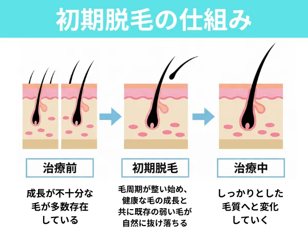 初期脱毛の仕組み