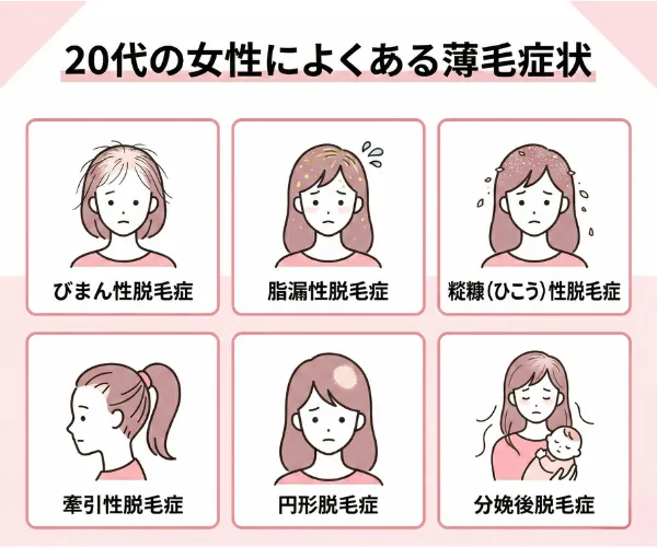 20代の女性によくある薄毛症状