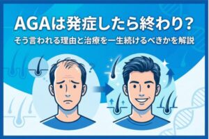 AGAは発症したら終わり？そう言われる理由と治療を一生続けるべきかを解説