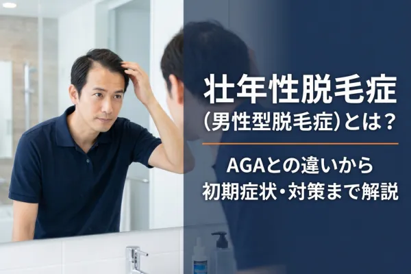 壮年性脱毛症（男性型脱毛症）とは？AGAとの違いから初期症状・対策まで解説