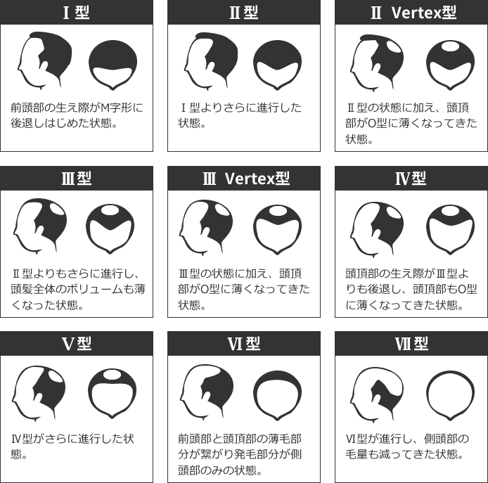 AGAパターン診断イメージ