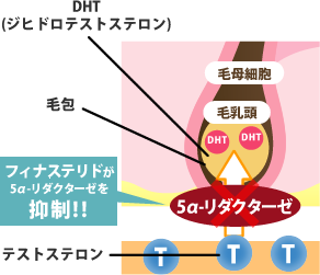 フィナステリドが5αリダクターゼを抑制